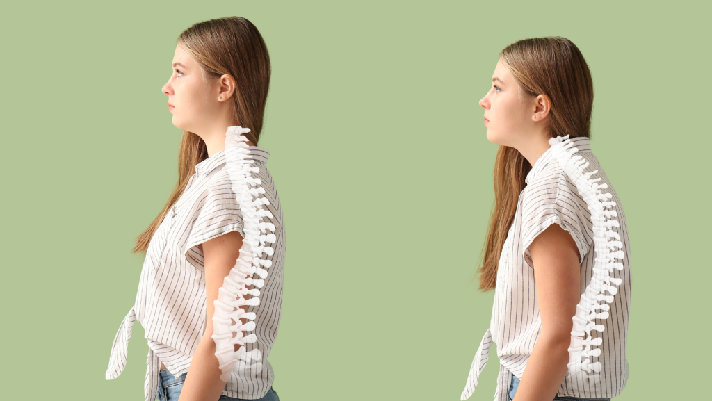 Improve Posture - Isometric Exercises