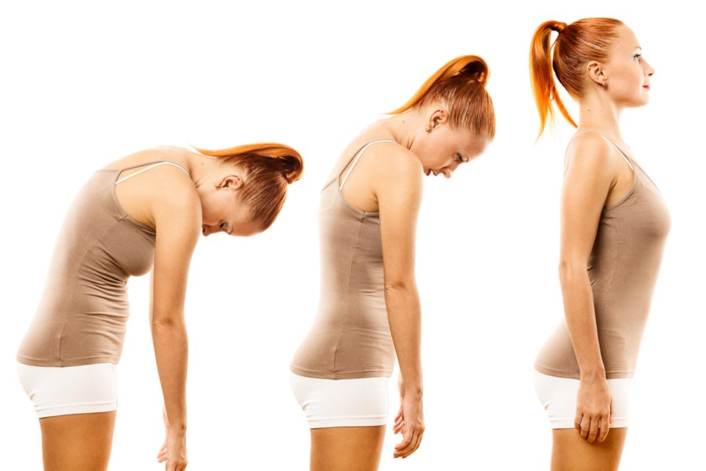 Is Good Posture a Myth?